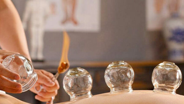 Cupping therapie