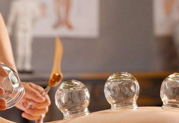 Hijama (cupping) Therapie