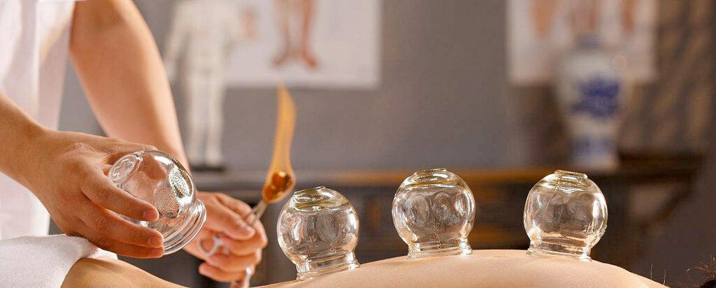 Hijama (cupping) Therapie